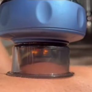 Vacuum Cupping Massage Anti Cellulite Magnet Therapy